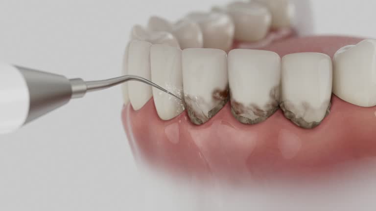 Reliable Wisdom Tooth Removal contractor in Lamar County County, GA by Dentist Open Now